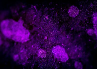 Senolytics & Cellular Senescence: Clearing the “Zombie Cells”