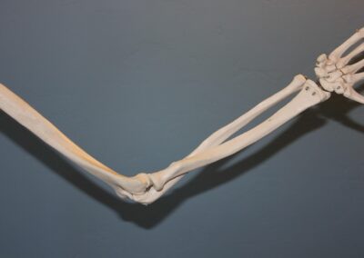 Regenerative Orthopedics & PRP: Advancing Beyond Cosmetic Peels